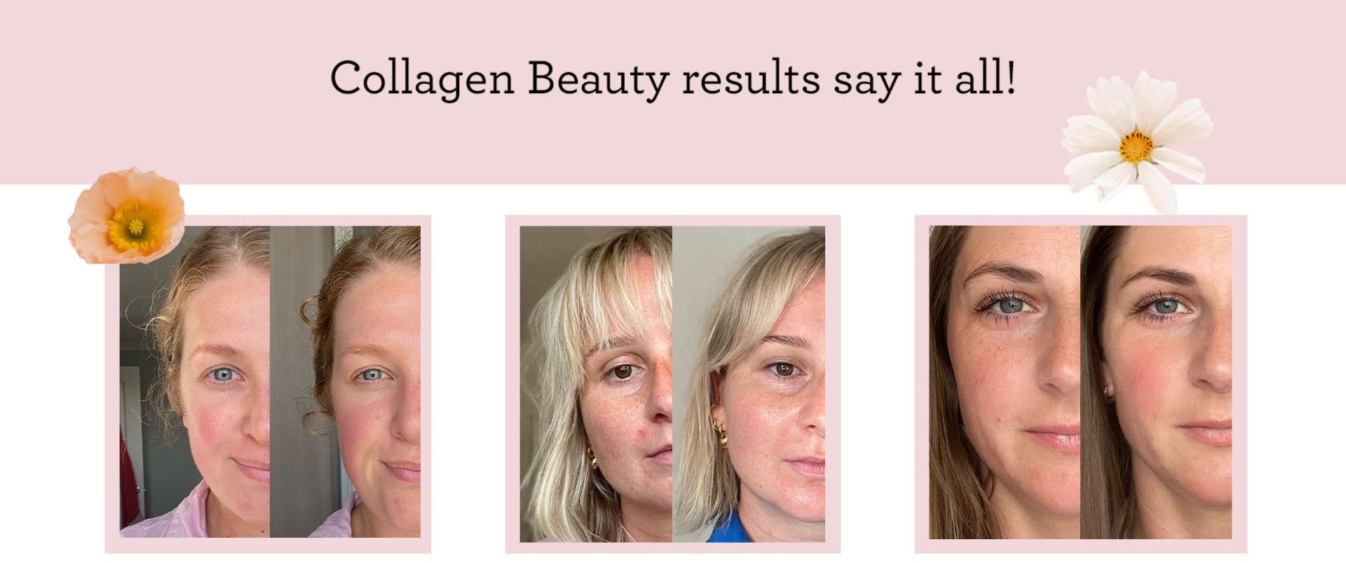 Collagen Beauty - before & afters