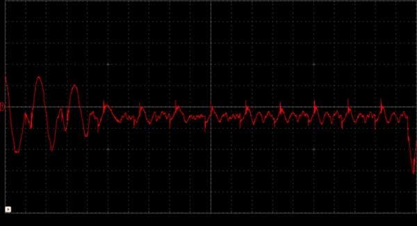 Imagem típica de ondas cerebrais observadas em CRO