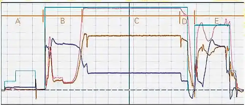 Modo de controle de pressão de circuito fechado completo