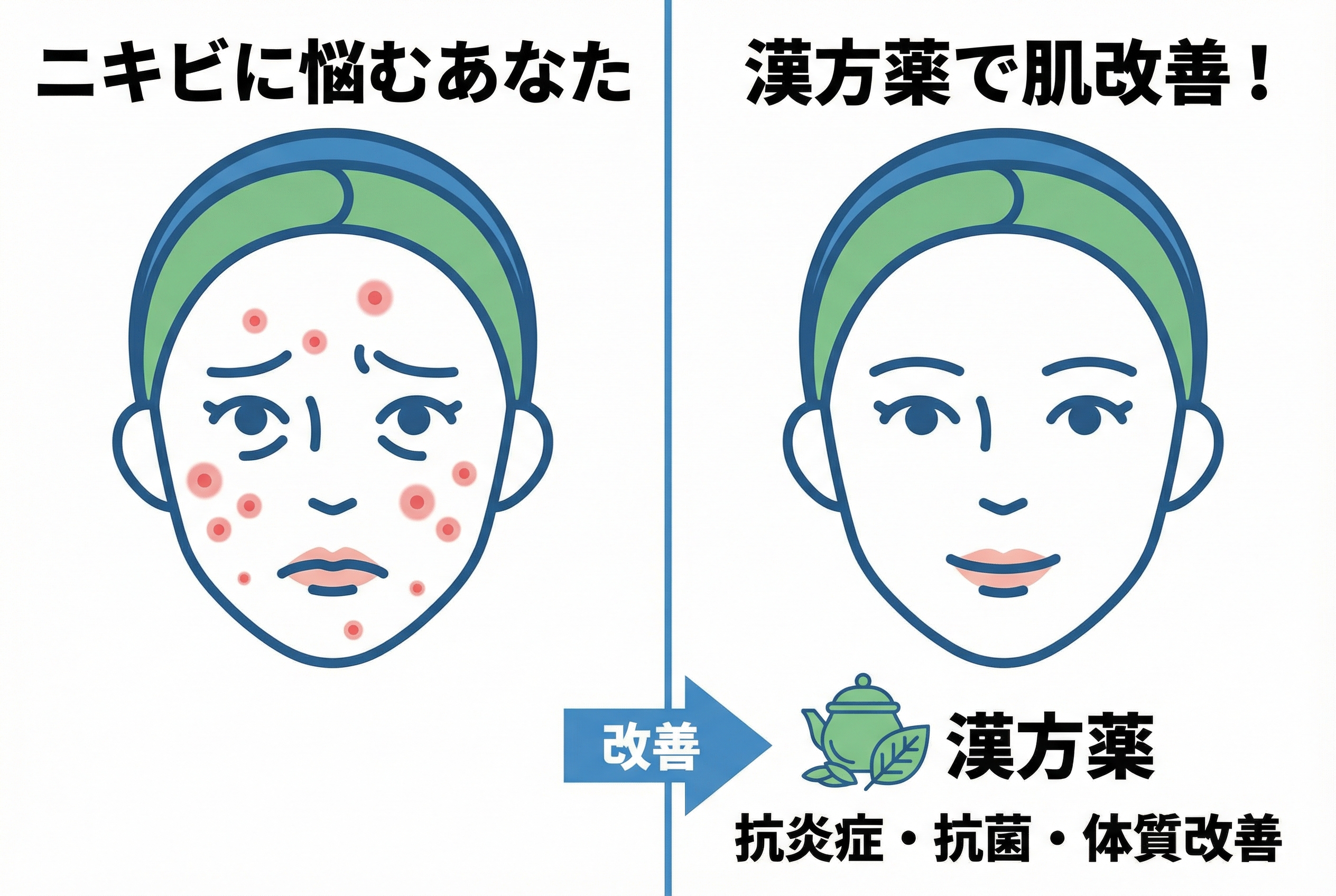 ニキビ漢方薬の基本知識と作用メカニズム