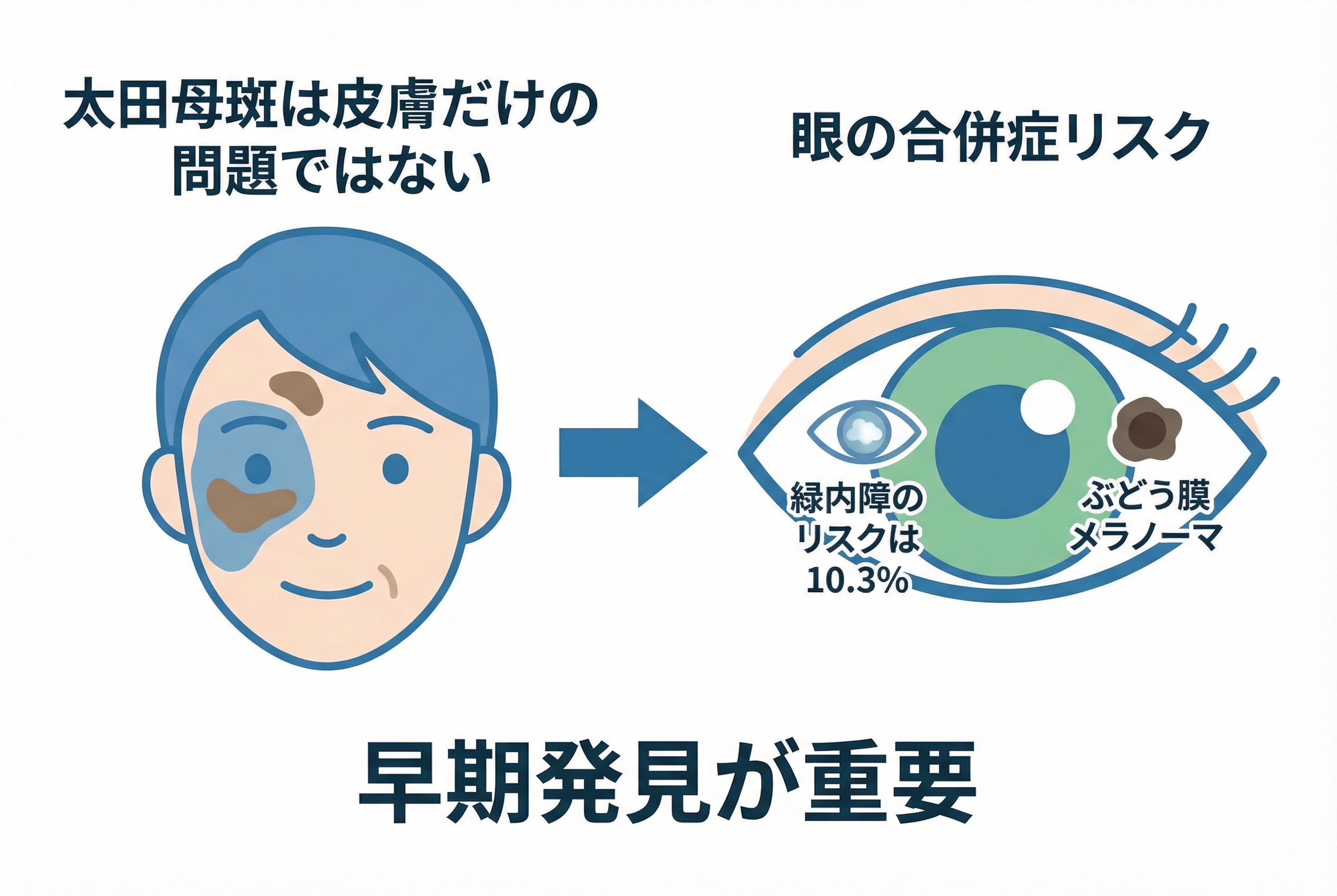 最新研究が解き明かす太田母斑の真実と合併症リスク