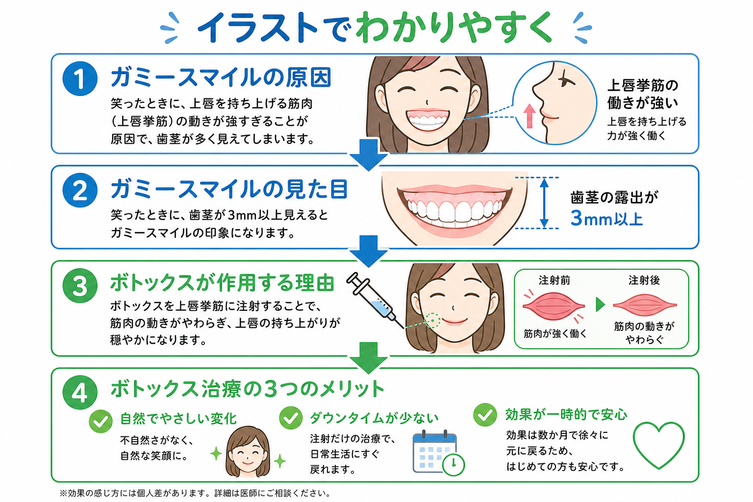 ガミースマイル ボトックス治療の仕組みと3つのメリット