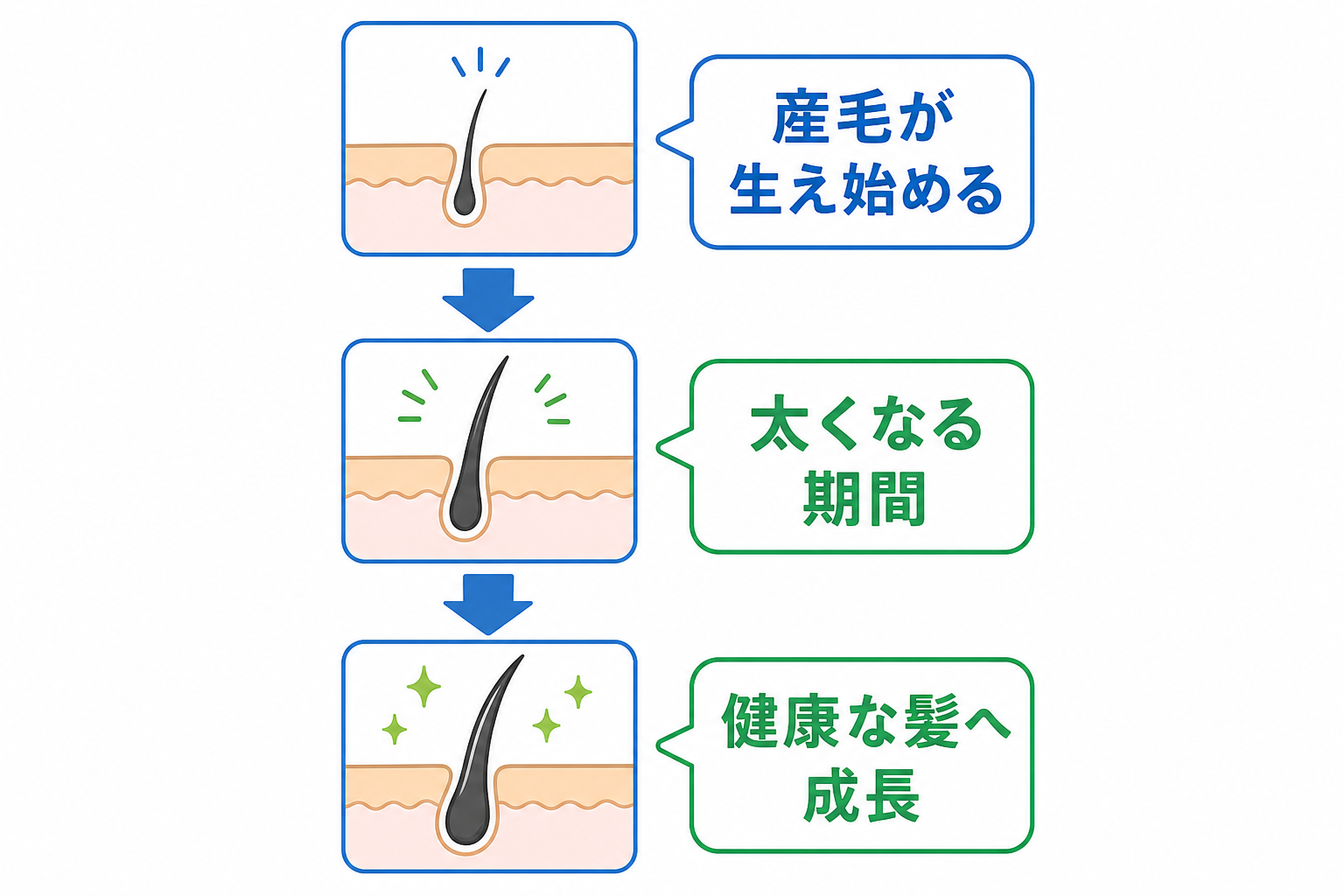 ミノキシジルによる発毛の仕組みと産毛が太くなるまでの過程