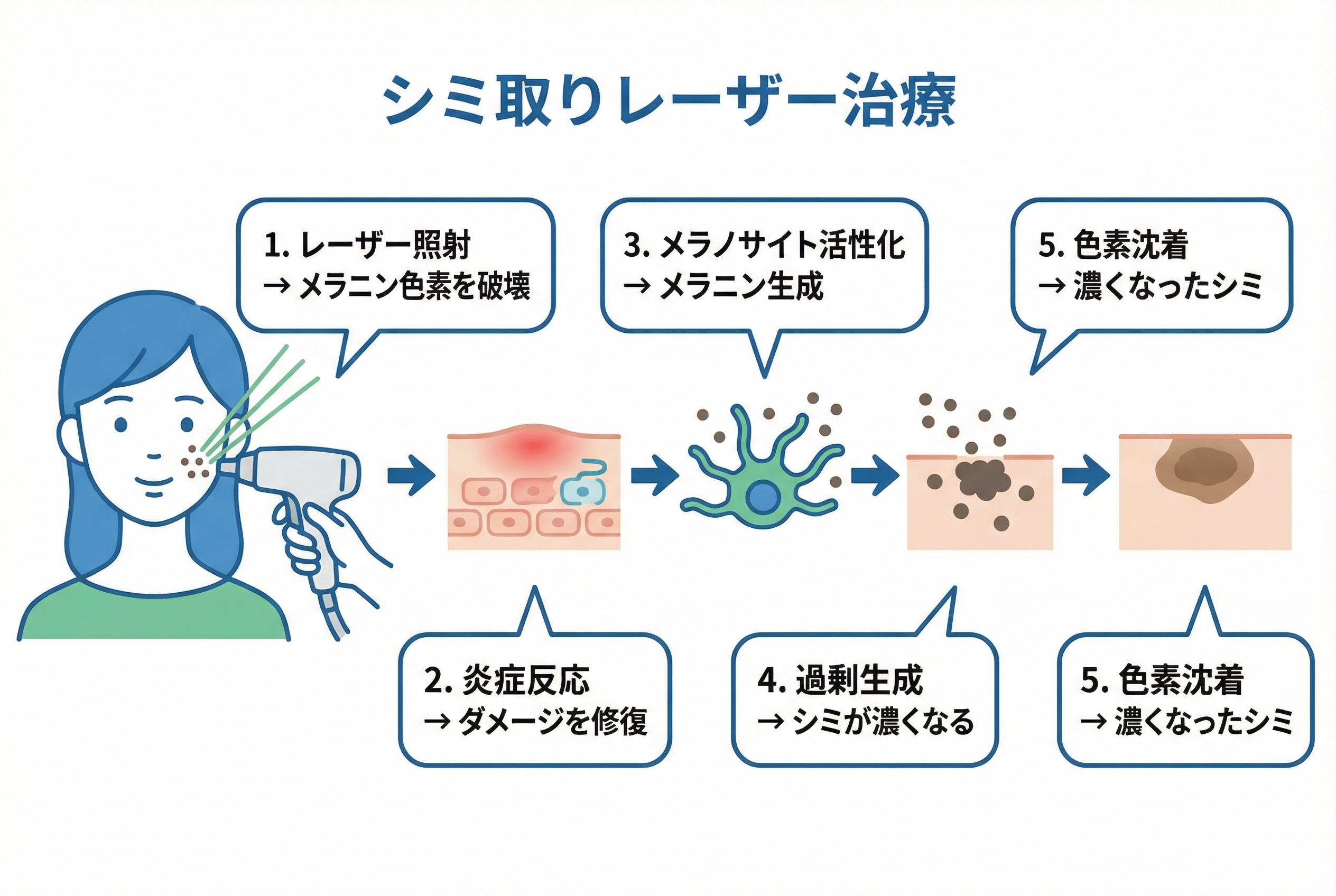 濃くなったシミを消すための治療法を徹底比較