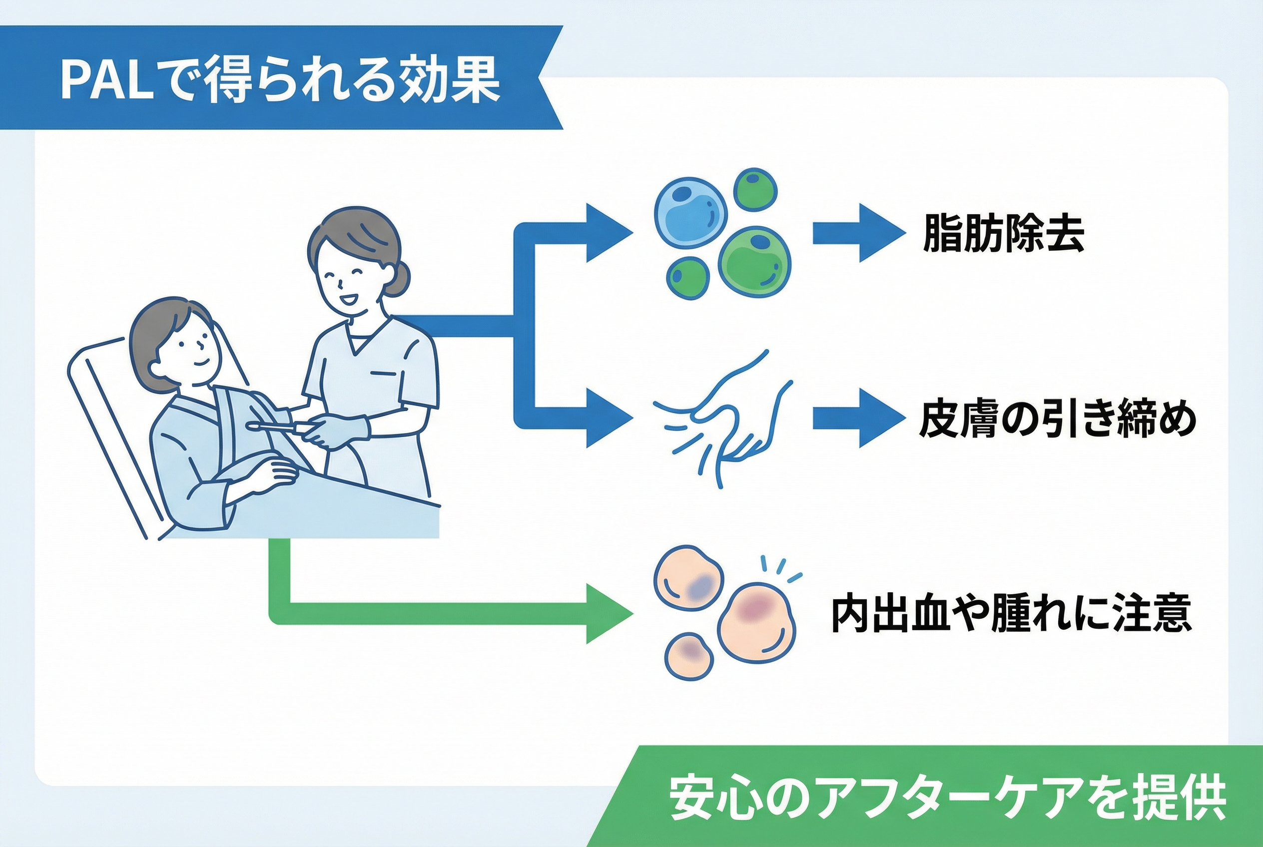 失敗しない！PALと他痩身術の比較からクリニック選びまで3つのポイント