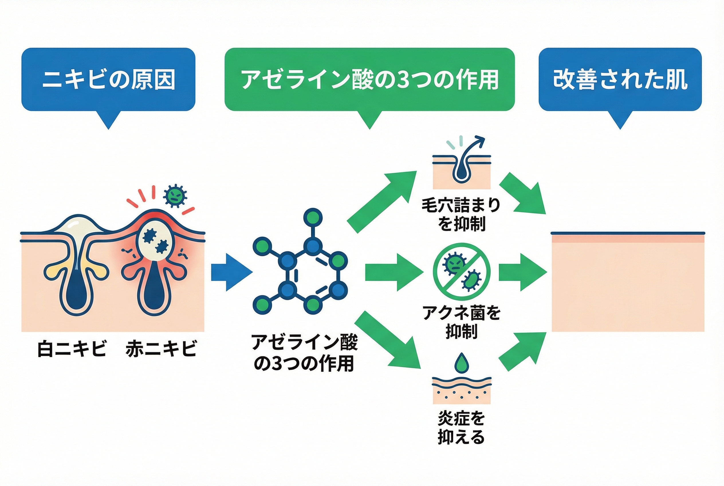 アゼライン酸の基本！ニキビへの効果と作用メカニズム