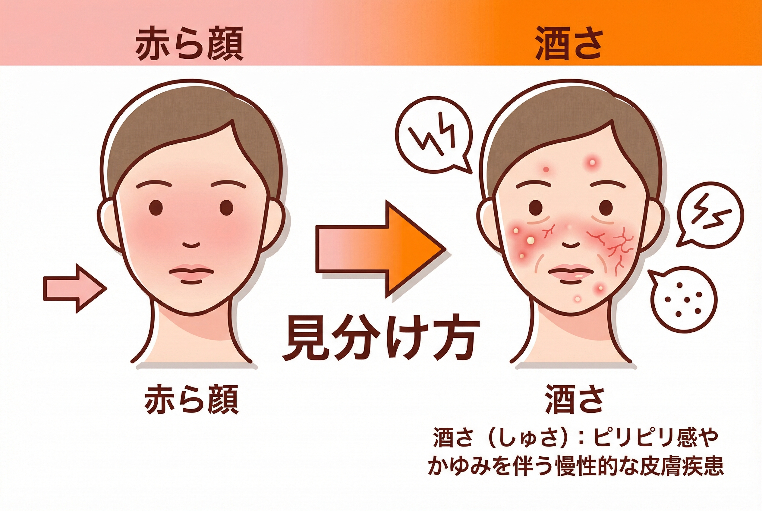 酒さの治療法5選:外用薬からレーザーまで - 画像 1