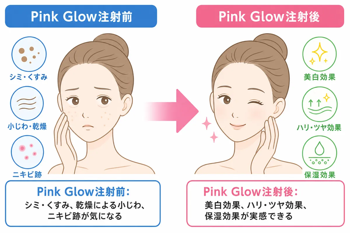 Pink Glow注射の5大効果|あなたの肌悩みにどう効く?