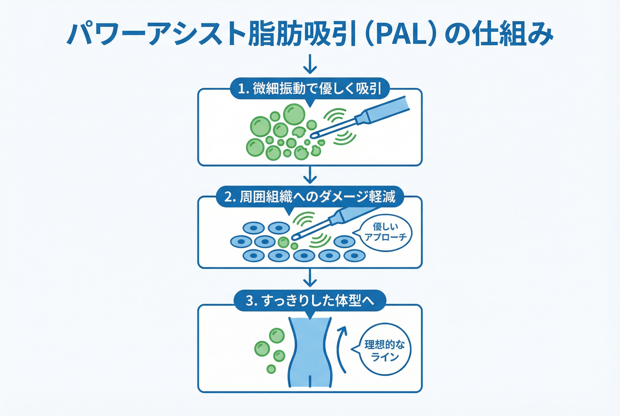 パワーアシスト脂肪吸引（PAL）とは？種類と仕組み3つ