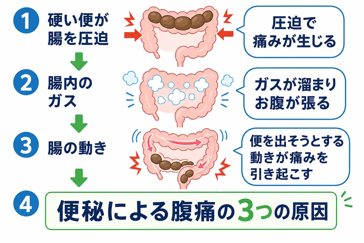 医師が解説する慢性便秘症の治療ゴール - 画像 1