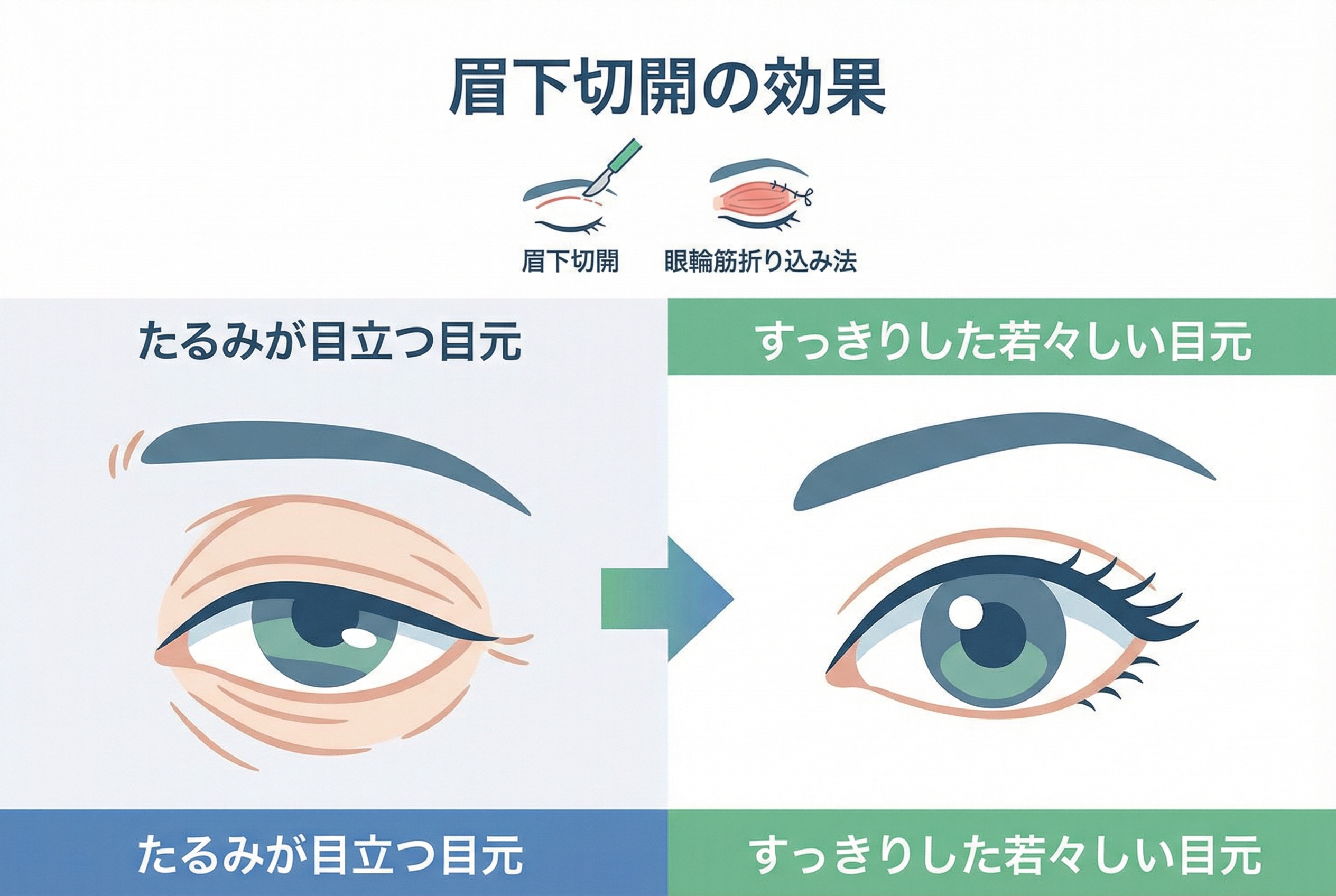 ただたるみを取るだけではない 同時施術で叶える複合的な目元の若返り