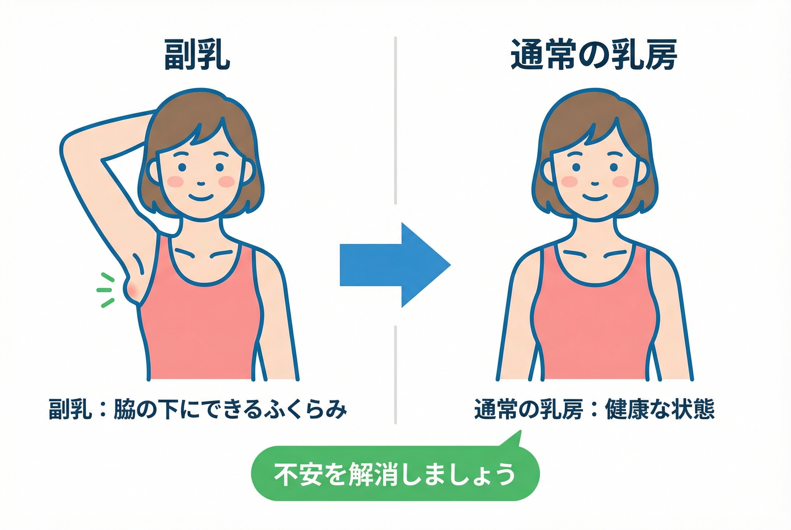 最新知見で解き明かす副乳の正体 - 日本人に多い理由とは