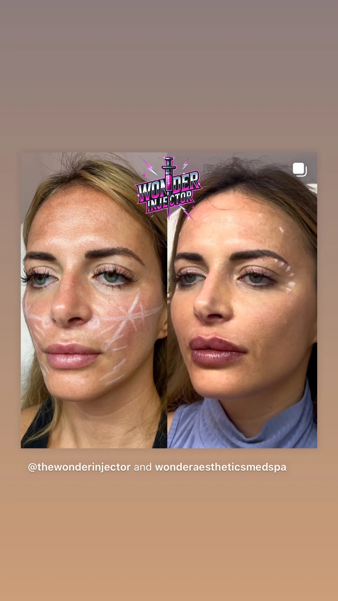 Wonder Aesthetics & Rejuvenation