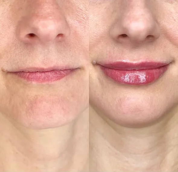 Skinvestment Aesthetics Clinic - Photo 2