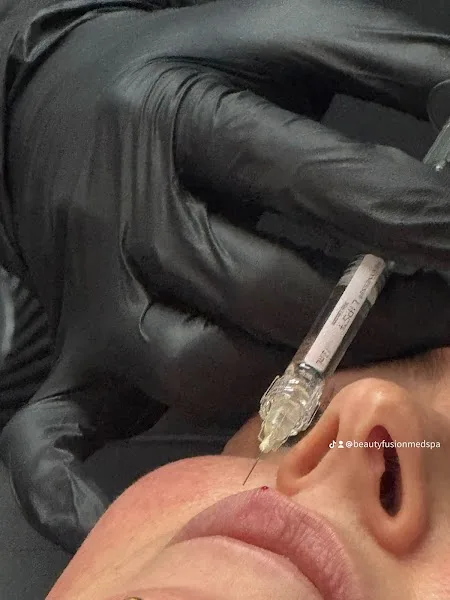 Beauty Fusion Med Spa