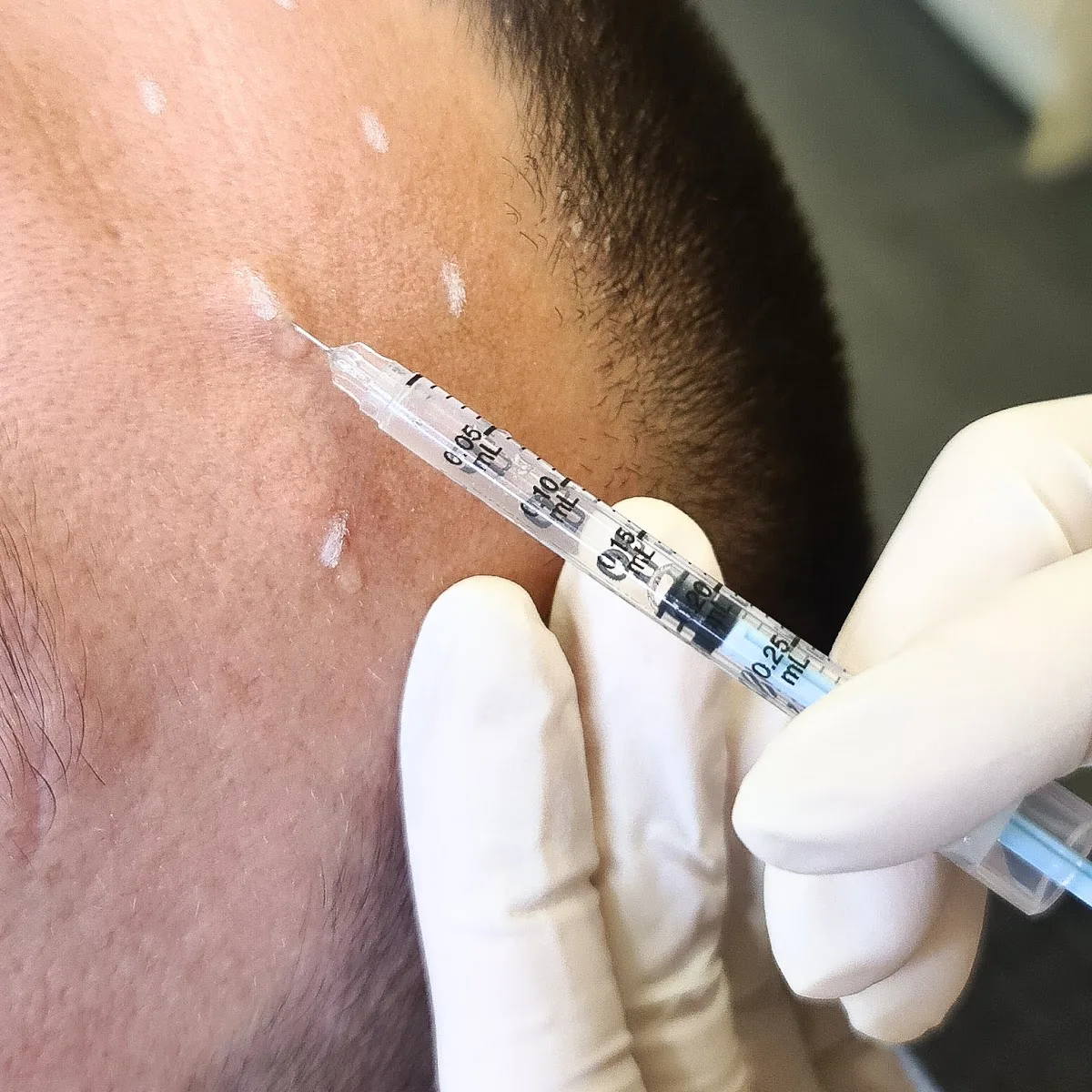 Evolution Laser Clinic Charlestown - Photo 2