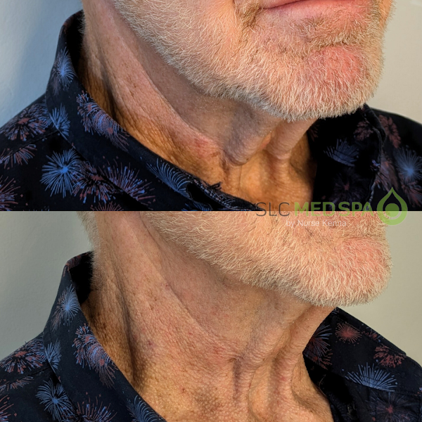 Draper Aesthetics - Photo 5