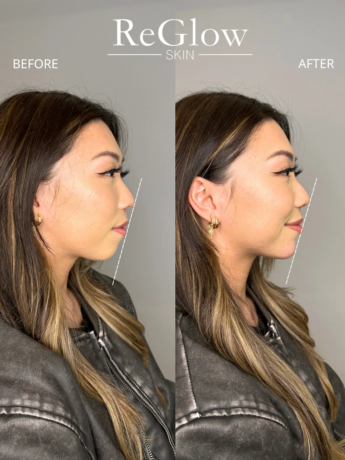 ReGlow Skin - Photo 5