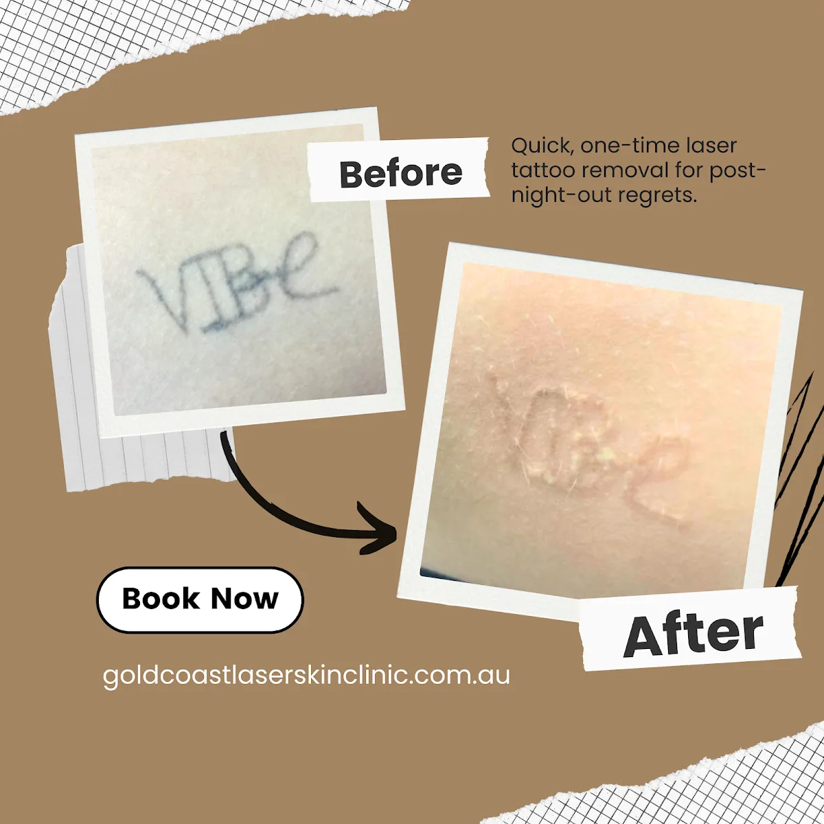 Gold Coast Laser Skin Clinic - Photo 5