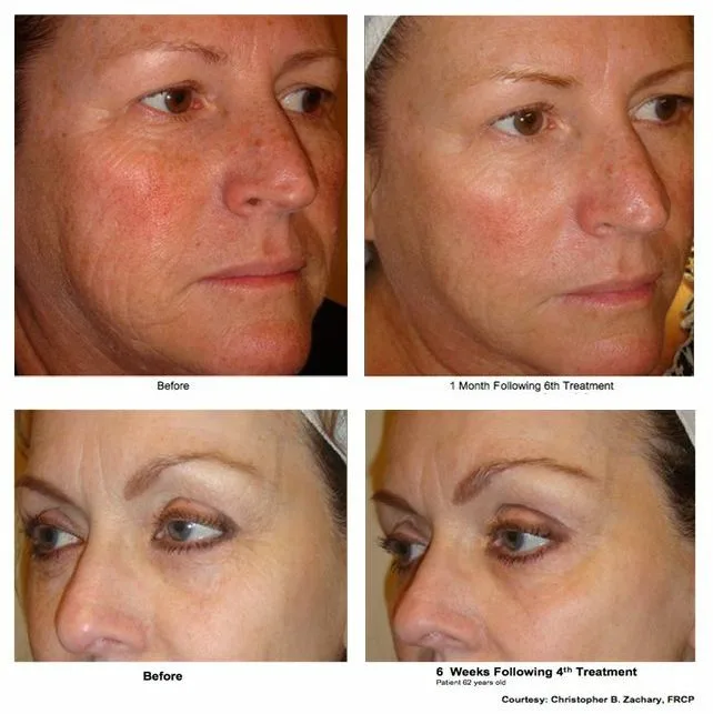 iSkin Clinics Australia - Photo 4