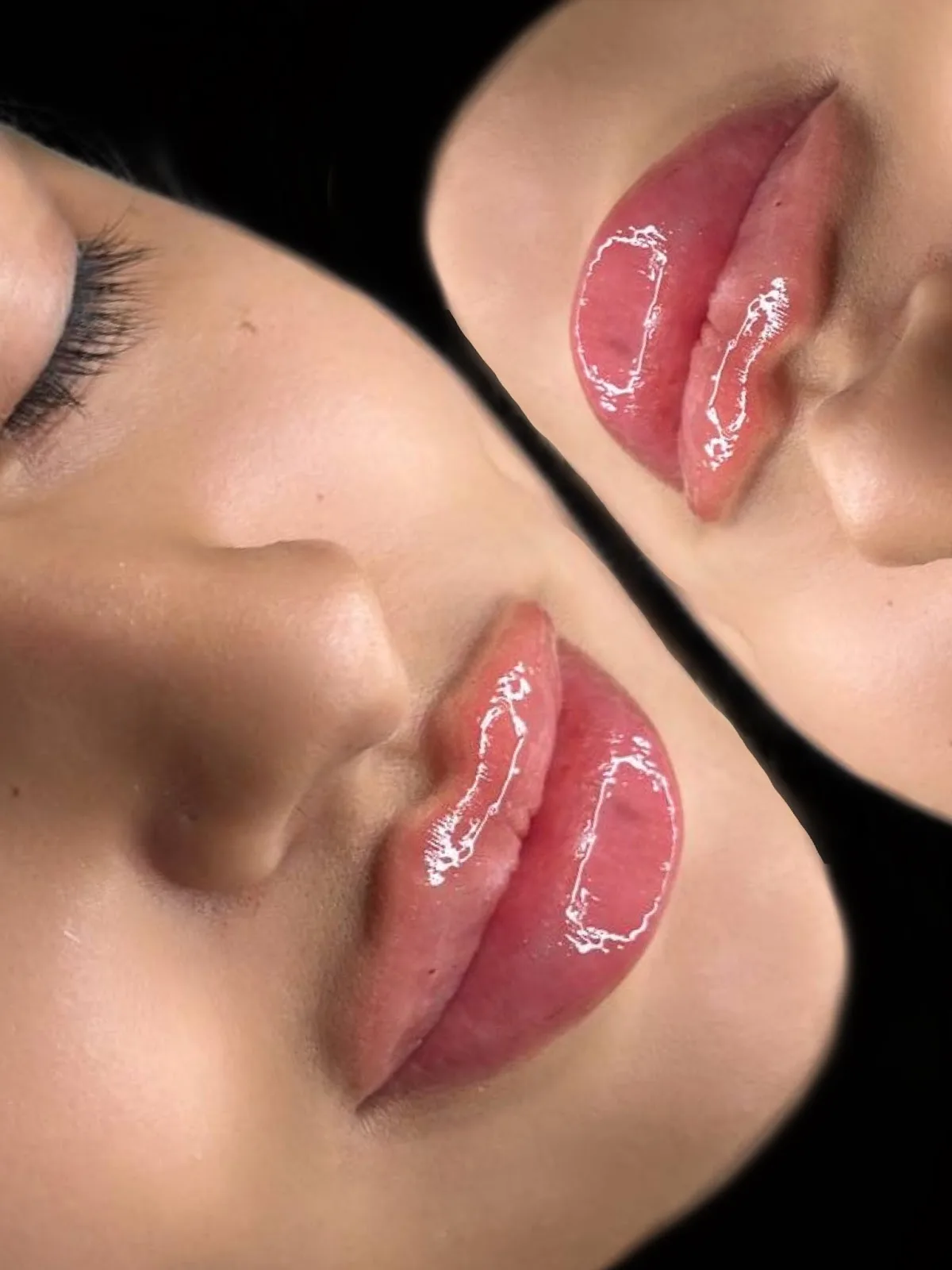 Joanna Injects Aesthetics