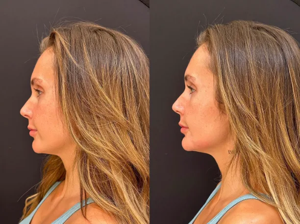 Allure Aesthetics - Photo 3