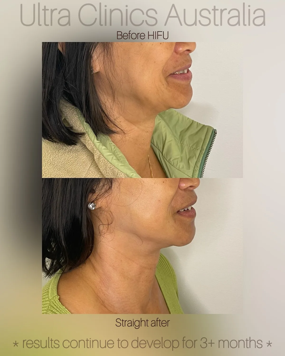 Ultra Clinics Australia - Adelaide - Photo 5