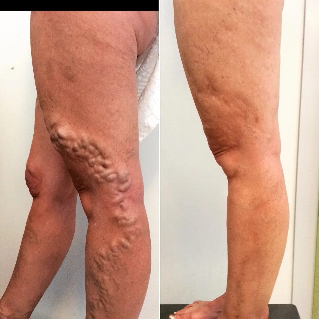 Sunshine Vein & Cosmetic Clinic - Photo 3