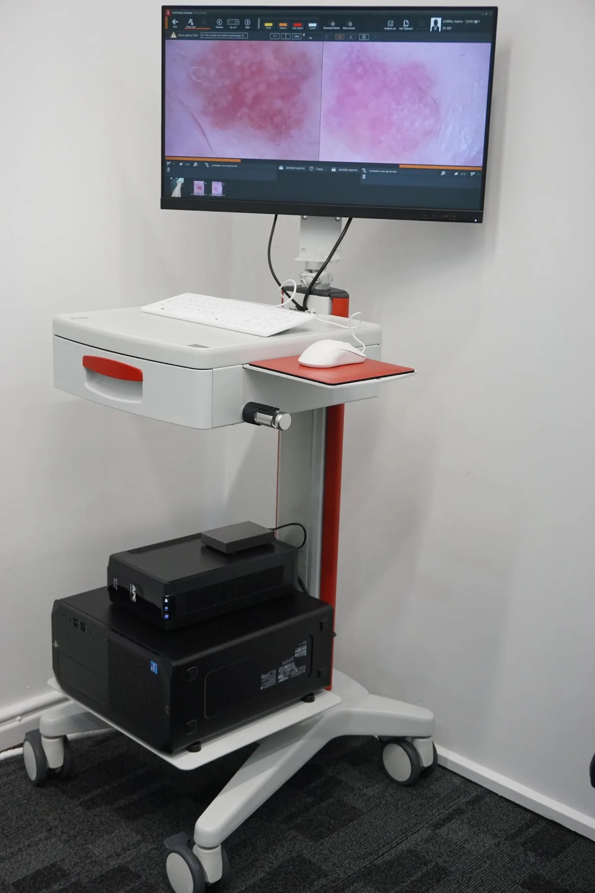 Skin Chex Adelaide - Photo 5