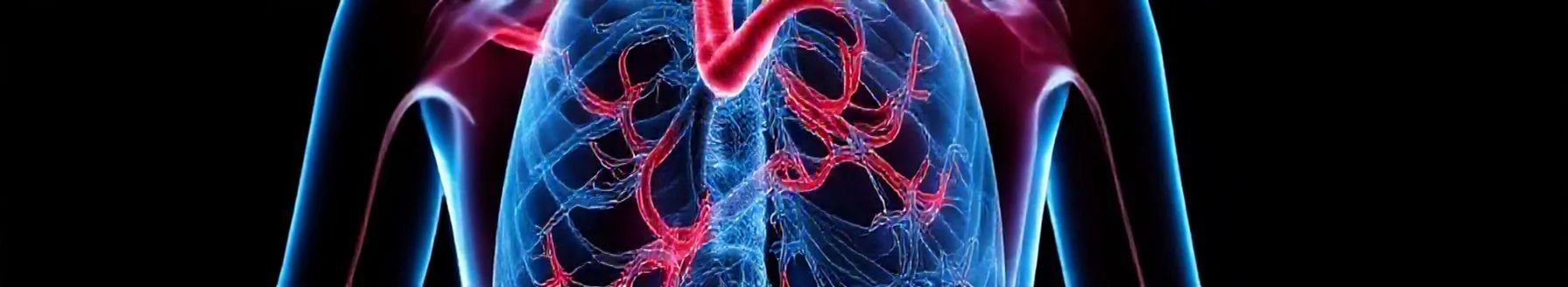 Aortic Aneurysms: What you need to Know