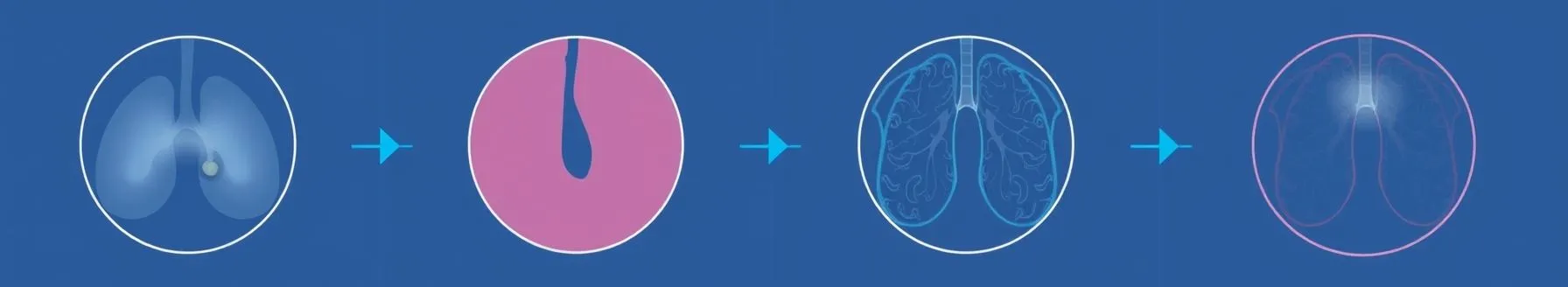 Approach to Benign Breast Diseases