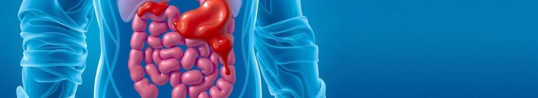 Non-Variceal Upper GI Bleeding