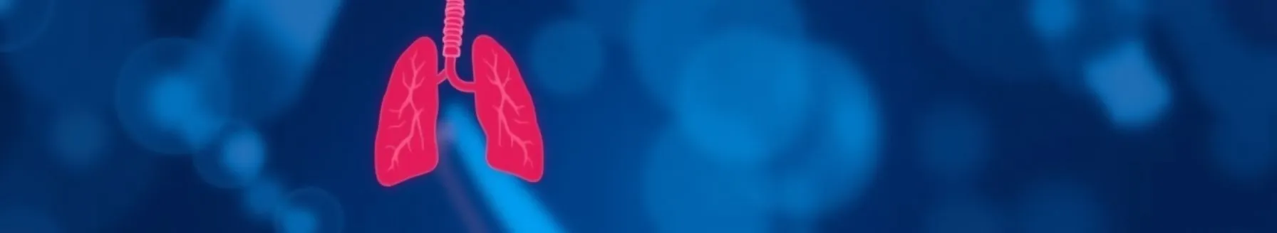 Tuberculosis Management