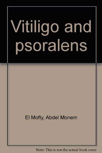 Vitiligo and psoralens