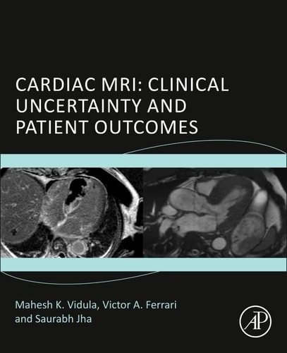 Cardiac MRI Clinical Uncertainty and Patient Outcomes