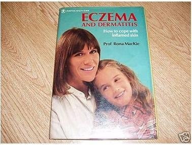 Eczema and Dermatitis : how to Cope with Inflamed Skin