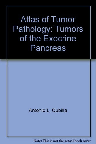 Atlas of Tumor Pathology: Tumors of the Exocrine Pancreas