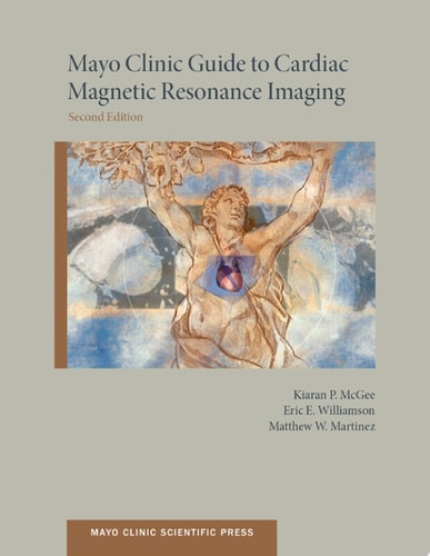 Mayo Clinic Guide To Cardiac Magnetic Resonance Imaging