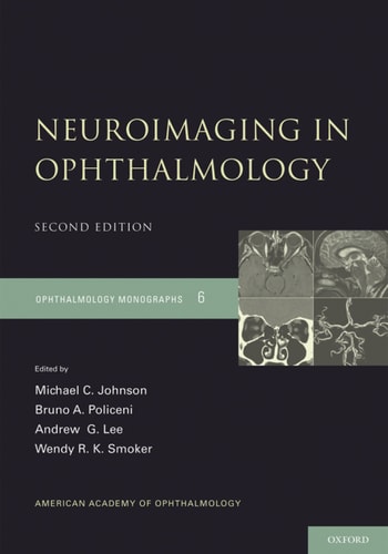 Neuroimaging in Ophthalmology