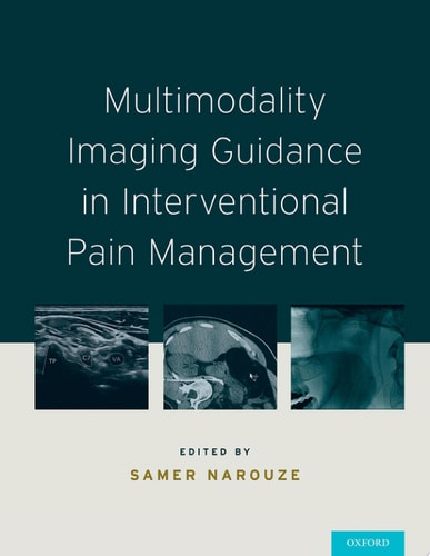 Multimodality Imaging Guidance in Interventional Pain Management
