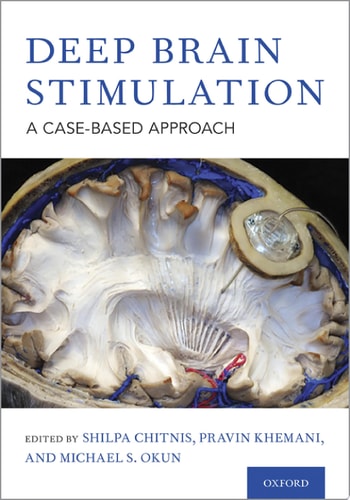 Deep Brain Stimulation A Case-Based Approach