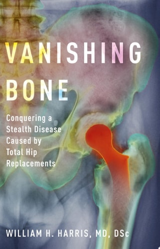 Vanishing Bone: Conquering A Stealth Disease Caused By Total Hip Replacements