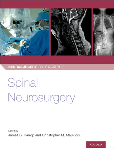 Spinal Neurosurgery (Neurosurgery by Example Book 3)