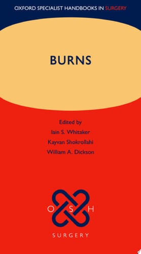 Burns
