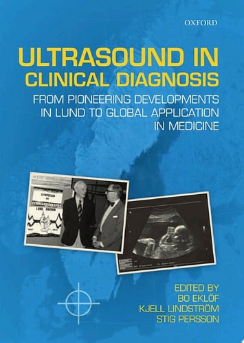 Ultrasound in Clinical Diagnosis: From Pioneering Developments in Lund to Global Application in Medicine