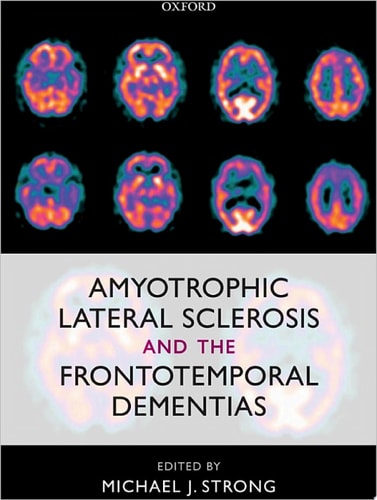 Amyotrophic Lateral Sclerosis and the Frontotemporal Dementias