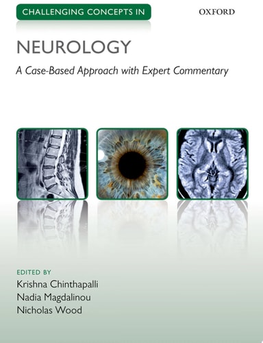 Challenging Concepts In Neurology