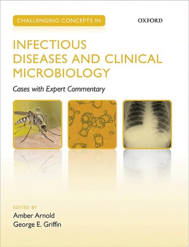 Challenging Concepts in Infectious Diseases and Clinical Microbiology: Cases with Expert Commentary