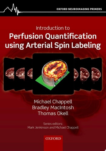 Introduction to Perfusion Quantification using Arterial Spin Labelling