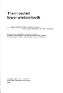The Impacted Lower Wisdom Tooth